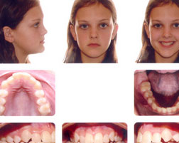 Orthodontic Photographs